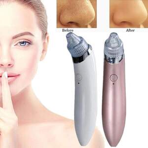 Вакуумный аппарат для чистки пор Beauty Skin Care Specialist XN-8030 Лучшая цена! Вакуумный аппарат для чистки пор Beauty Skin Care Specialist XN-8030 Лучшая цена!